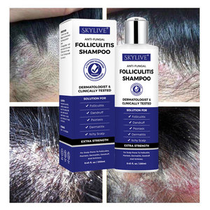 Champú para Eccema y Psoriasis de Marca Blanca, Alivio Anticaspa para Cuero Cabelludo Seco y con Picazón, Fórmula Libre para Cuero Cabelludo Sensible, Hipoalergénico - Product Image 2