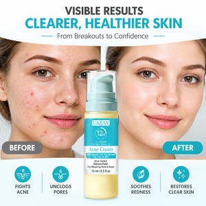 Crème <span class=keywords><strong>anti</strong></span>-acné à marque privée, soin du visage pour peaux à tendance <span class=keywords><strong>acnéique</strong></span>, contrôle du sébum, soulagement des rougeurs avec acide salicylique, vente en gros - Product Image 1