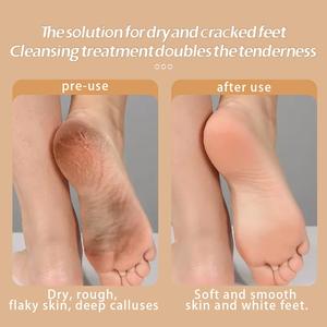 Amoladora eléctrica para pies, máquina <span class=keywords><strong>de</strong></span> belleza para pies y eliminación <span class=keywords><strong>de</strong></span> piel muerta y callos totalmente automática para el hogar - Product Image 4