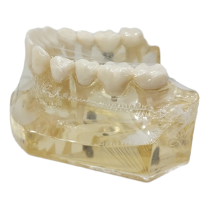 علوم طبية دراسة طبيب الأسنان موارد تعليمية إلكترونية محاكاة عالية الجودة راتنج زرع الأسنان الفك السفلي - Product Image 6