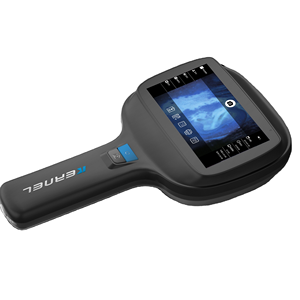 Analyseur de peau faciale KN-9000A le dispositif de <span class=keywords><strong>diagnostic</strong></span> de maladie de la peau de dermatoscope médical pour l'examen de trouble de la peau - Product Image 1