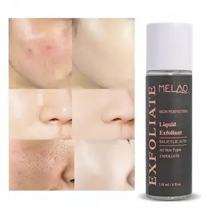 salicylic acid serum 30% Chemical Peel with Rosacea, Blackheads, Whiteheads, Clogged Pores