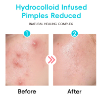 Dotdot Traitement de l'acné Soins de la peau Matériau de qualité médicale Patch hydrocolloïde coloré pour boutons d'acné