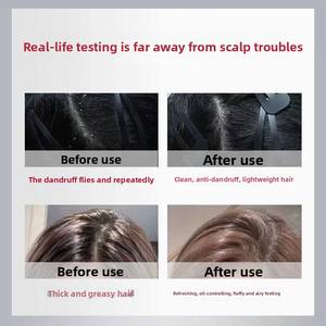 <span class=keywords><strong>แชมพู</strong></span>สูตรอ่อนโยนสำหรับหนังศีรษะ ลดรังแค เซเลเนียม ไดซัลไฟด์ ชนิดน้ำ ควบคุมความมัน บำรุง ให้ความเรียบลื่น สดชื่น สำหรับผมมัน - Product Image 5