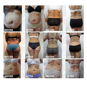 Latest Pressotherapy Body Lymphatic Drainage Arms Leg <b>Massager</b> Pressotherapy Boots Air Pressure Suit 24 Chambers <b>Machine</b> - Product Image 6