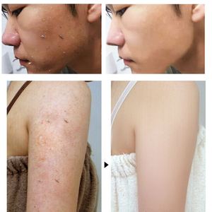 Savon exfoliant blanchissant anti-acné au lait de coco pour le corps, soin nettoyant pour adoucir et régénérer <span class=keywords><strong>la</strong></span> peau - Product Image 6