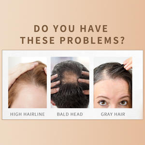 Polvo para el Cabello de Fibra Vegetal de Uso Amplio, Venta Caliente - Product Image 6