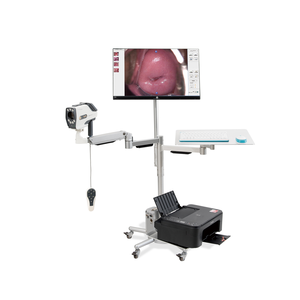 Ikeda quang video phụ khoa <span class=keywords><strong>colposcope</strong></span> nhựa thiết bị chẩn đoán cho bệnh viện phòng khám điện nhà máy cung cấp - Product Image 3