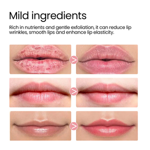 Mascarilla Labial Eelhoe de 4 Sabores: Fresa, Uva, Pomelo y Melocotón, OEM, Hidratante, Exfoliante y Nutritiva, Bálsamo Labial - Product Image 5