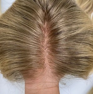Toppers de Nudos Individuales para <span class=keywords><strong>Mujer</strong></span>, Postizos Rubios, Prótesis Capilar de Encaje HD Invisible, Toupées de Cabello Humano Virgen Remy con Cutícula Alineada - Product Image 1