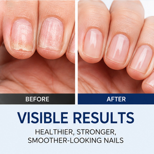 Hot Sale Strengthen Brittle Split Fingernail Toenail Nourishing Softens Thins Thick Multi-Purpose <b>Nail</b> Repair Serum - Product Image 2