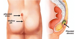 Xách tay <span class=keywords><strong>2025</strong></span> <span class=keywords><strong>Diode</strong></span> <span class=keywords><strong>Laser</strong></span> máy đẹp 1470nm 980nm chất béo giảm mạch máu phương pháp điều trị móng tay Nấm chữa bệnh cho chăm sóc nha khoa - Product Image 3