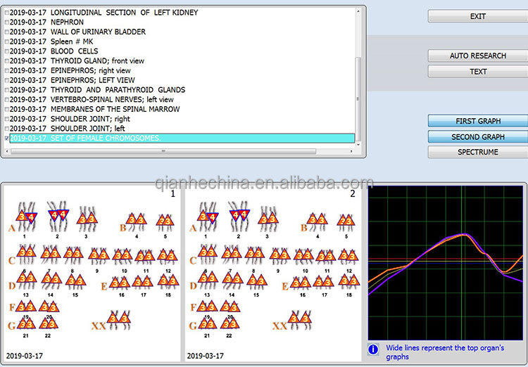 Hot selling 12d aura nls health analyzer with factory price