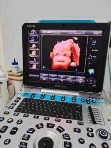 Échographe Doppler Couleur Portable Avancé Dawei DW-P30 avec Imagerie 4D pour le Diagnostic Hospitalier Humain - Product Image 4