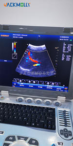 Ecografo الموجات فوق الصوتية الرقمية للقلب بالألوان دوبلر ثلاثي الأبعاد 4d صدى طبي للإنسان - Product Image 3