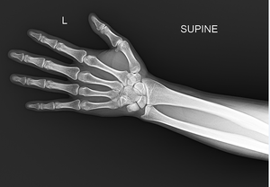 Careray-Detector de panel plano digital <span class=keywords><strong>Dr</strong></span>, software multilenguaje, equipo de radiología, accesorios careview 1500cw 1800cw - Product Image 4