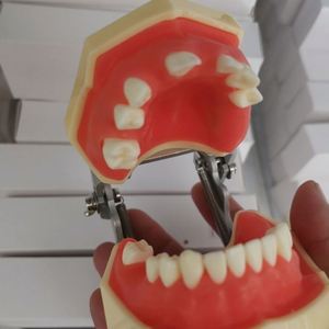 Modello di impianto dentale KyrenMed con edentulismo parziale nelle mascelle superiori e inferiori denti modello di pratica mancante - Product Image 6