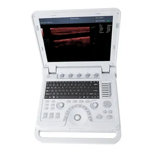 Contec cms600p2 scanner portátil ce 12.1 polegadas, ultrassom convexo de cor