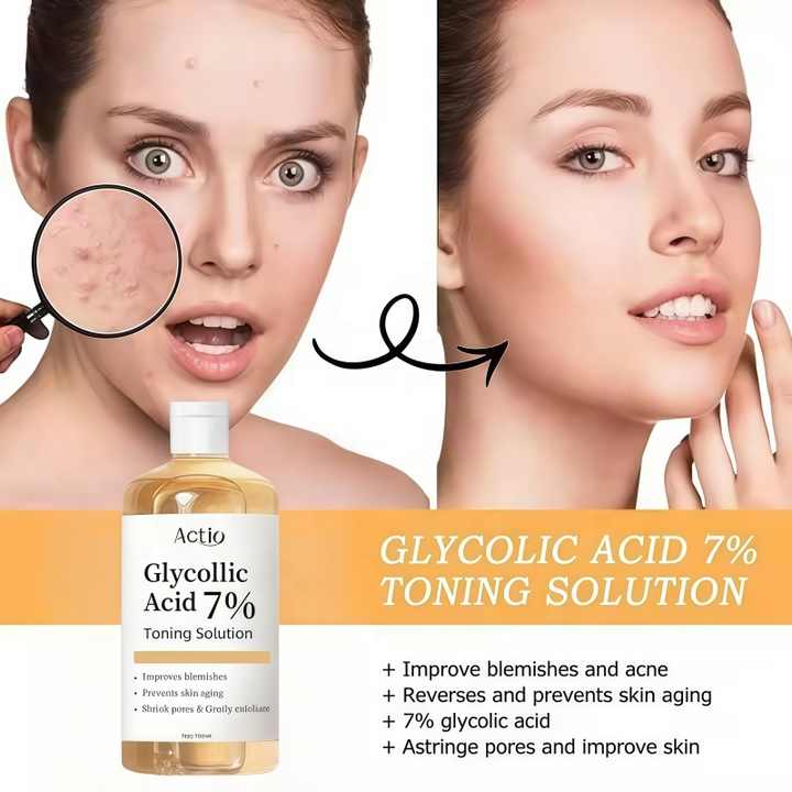 View of Natural Glycolic Acid Toner Lotion to Remove Blackheads and Exfoliate ...