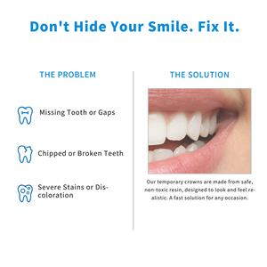 50 ชิ้น ชุดซ่อมฟันชั่วคราว วีเนียร์เรซิ่น A1 A2 ฟันปลอมเครื่องสำอาง ปิดช่องว่างฟันแตก เพื่อรอยยิ้มสวยงามทันที DIY - Product Image 3