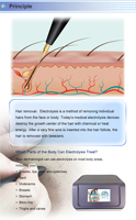 Épilateur thermolysant professionnel de précision 27 MHz pour salon, avec aiguille, pour une épilation efficace et une thérapie de beauté avancée