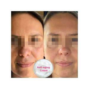 Young <span class=keywords><strong>Forever</strong></span> M Cream pour les femmes atteignent une peau jeune et radieuse avec un beau teint visible - Product Image 3