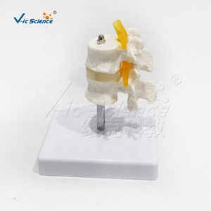 Modèle de colonne lombaire à deux segments avec disque fonctionnel, spécimen de <span class=keywords><strong>test</strong></span> biomecanique L3-L4 L4-L5, aide pédagogique médicale - Product Image 6