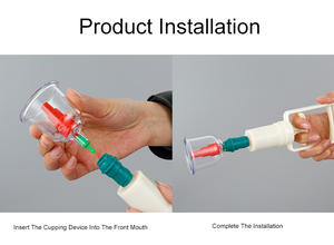 Juego de Ventosas de vacío chinas, juego de ventosas de 12 piezas - Product Image 6