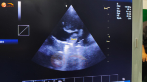 SUN-906B 15 inch draagbare echografiemachine Professionele veterinaire software Kleur <span class=keywords><strong>Doppler</strong></span>-scanner - Product Image 5