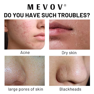 Masque à l'argile d'aubergine <span class=keywords><strong>de</strong></span> marque privée bâton éliminant les <span class=keywords><strong>points</strong></span> <span class=keywords><strong>noirs</strong></span> contrôle huile exfoliante apaisante peau d'acné masque facial - Product Image 4