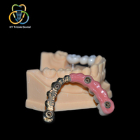 Porcelaine esthétique pour gencives, céramique rose pour implant dentaire, couronne, pont, prothèse, simulation de tissus mous