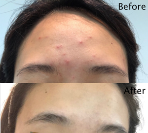 ETRUN ALISA, suero de aceite facial de azafrán con <span class=keywords><strong>vitamina</strong></span> <span class=keywords><strong>C</strong></span> iluminadora de Etiqueta Privada, eliminador de manchas oscuras de acné, suero corrector de piel - Product Image 6
