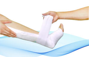 <span class=keywords><strong>Splint</strong></span> lengan medis <span class=keywords><strong>Moldable</strong></span>, <span class=keywords><strong>splint</strong></span> kaki serat kaca ortopedi - Product Image 2