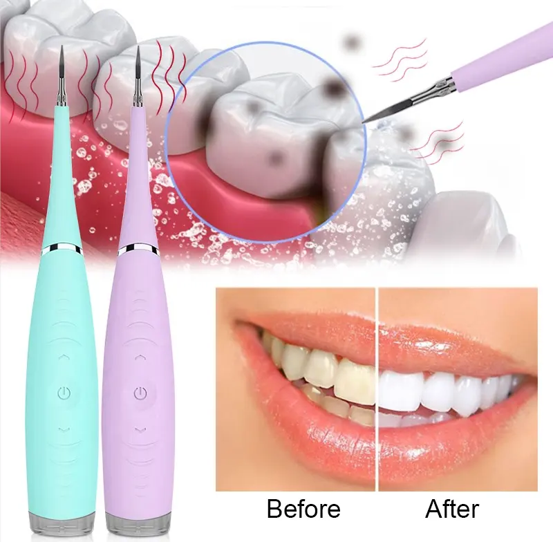 सबसे अच्छा मौखिक दांत Whitening उपकरण पानी सफाई चिकित्सकीय Scaler पोर्टेबल पथरी पदच्युत मशीन इलेक्ट्रिक अल्ट्रासोनिक टूथ क्लीनर