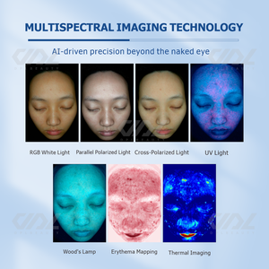 Nouvel analyseur de peau facial à 7 faces avec lumière UV, scanner 3D avec connexion USB pour une utilisation domestique en Asie, système Android IA - Product Image 3