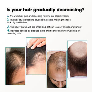 <span class=keywords><strong>Sérum</strong></span> Capillaire QBEKA pour la Croissance des <span class=keywords><strong>Cheveux</strong></span>, Non Gras, à la Biotine, Traitement de Repousse pour Femmes - Product Image 3