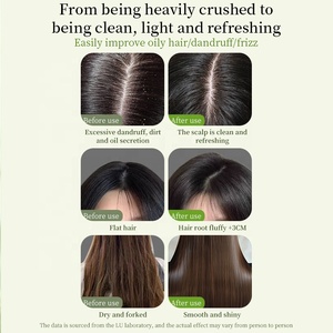 Shampoo Solido Artigianale Portatile al Tè Verde Naturale e Burro di Karité per il Controllo dell'Olio, Antiforfora e Crescita dei Capelli - Product Image 5