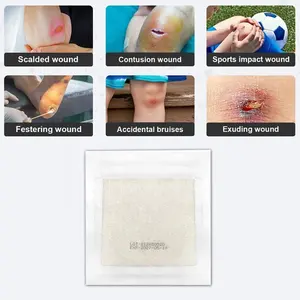 Curativo de Alginate para Feridas, Curativo de Cuidado de Feridas com Alginate de Cálcio, Curativo de Fibra para Trauma e Úlceras Diabéticas - Product Image 6