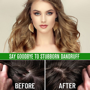 Aceite Hidratante Vegano Herbal Orgánico de Batana Aliver, Nutre el Cabello, Suaviza el Frizz, Mejora la Esencia, Aceite de Batana para Todo Tipo de Cabello - Product Image 4