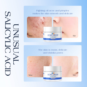 ครีมทีดับเบิ้ลยูจี อาร์ทีเอส ฮอตเซลล์ ครีมลดสิวผสมกรดซาลิไซลิก บำรุงผิวชุ่มชื้น ปรับสภาพผิวที่มีปัญหาสิว ครีมบำรุงผิวหน้าผสมกรดซาลิไซลิก - Product Image 3