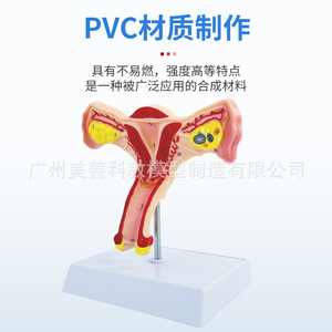 Modèle de simulation pédagogique de l'anatomie de l'utérus et des ovaires humains ; modèle d'anatomie interne reproductive féminine ; formation en gynécologie - Product Image 1