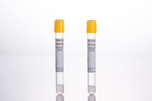 9ml PET-Glasblut-Reagenzglas <span class=keywords><strong>EDTA</strong></span> Vacutainer-Vakuums ammel probe für klinische Tests - Product Image 4