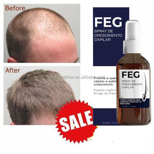 Gratis sampel perawatan kepala botak YUDA dan FEG penumbuh ulang rambut, perawatan rambut rontok baru ANTI kit semprotan rambut rontok - Product Image 2