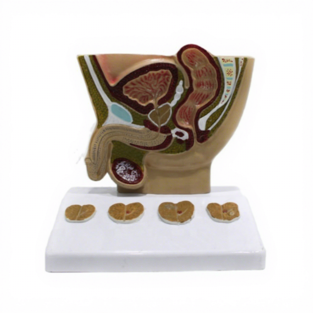 Medical Anatomical Model Manufacture Medical Anatomic Prostate Model Medical Science Education Model