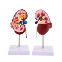 Modelo de Riñón Patológico y Normal - Simulación de Enseñanza de Urología, Modelo de Anatomía y Estructura del Riñón Humano
