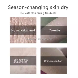 Idro dermoabrasione facciale di Mousse di idrogeno bolla 400ml di acqua soluzione di pulizia profonda liquido per la macchina di ossigeno - Product Image 5