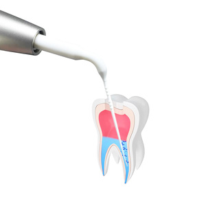 Producto Dental Más Vendido: Activador de Scaler Neumático con Funciones de Activación, Irrigación y Limpieza <span class=keywords><strong>Periodontal</strong></span> - Product Image 5