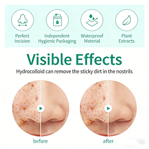 แผ่นแปะจมูกสิวแผ่นแปะรูขุมขนไฮโดรคอลลอยด์ขนาดใหญ่สำหรับค้างคืนแถบกำจัดสิวหัวดำเพื่อดูดซับสิวจมูกจากใบหน้า - Product Image 2