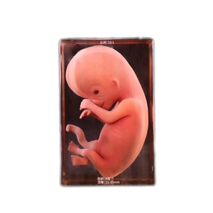 Modèle d'embryon imprimé en 3D d'embryons malformés Apprentissage de l'<span class=keywords><strong>embryologie</strong></span> pour l'éducation médicale - Product Image 1
