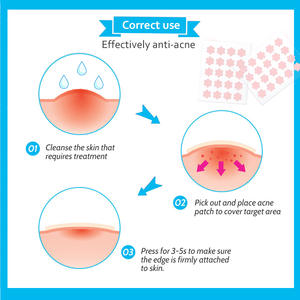 Parche de espinillas en forma de estrella Etiqueta privada Parches de acné lindos Parches de hidrocoloide de espinillas <span class=keywords><strong>para</strong></span> <span class=keywords><strong>el</strong></span> cuidado de la piel - Product Image 2